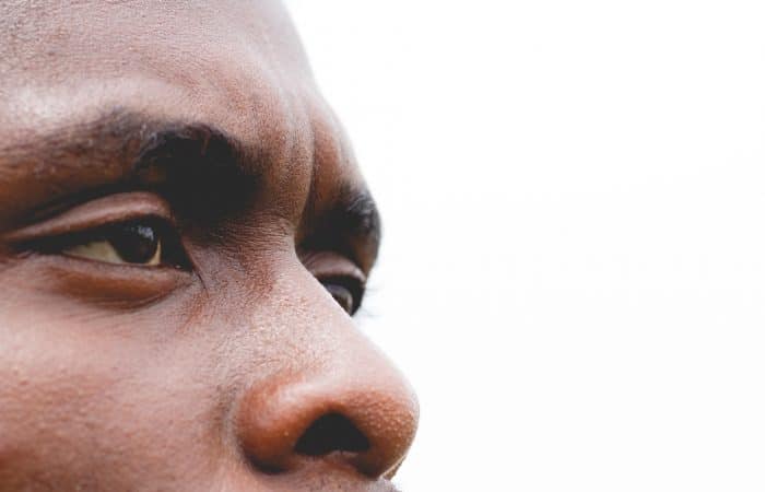 Volontariato in Kenya malati di cancro